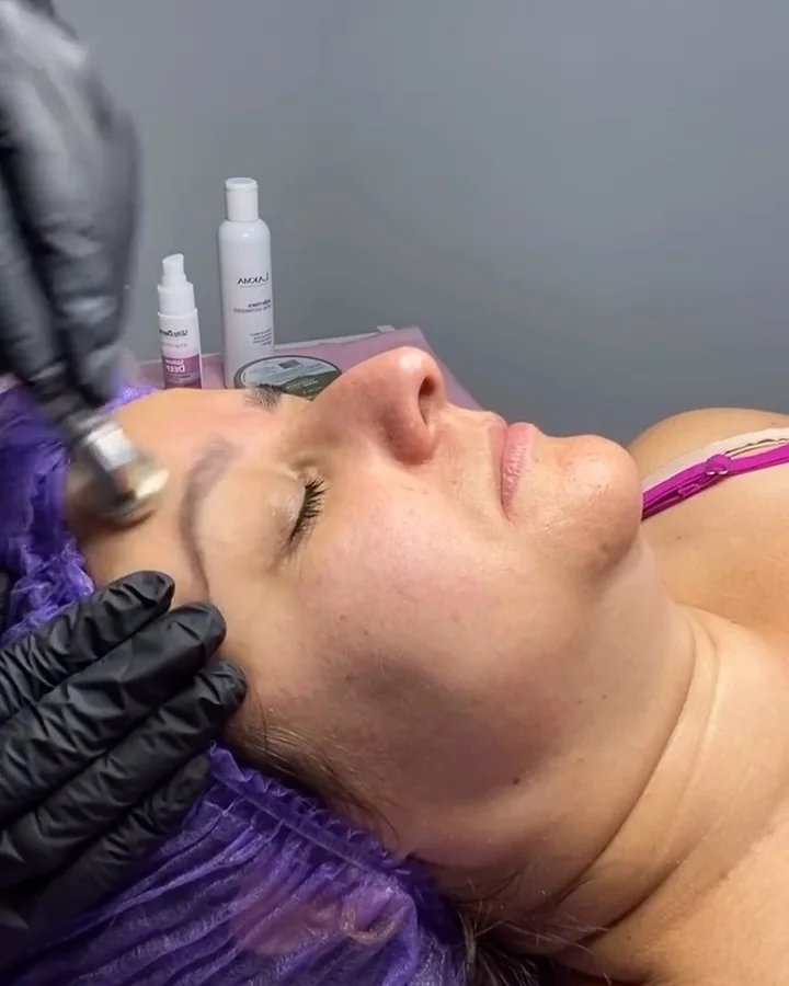 Ponteira do peeling de diamante passando no rosto de uma cliente