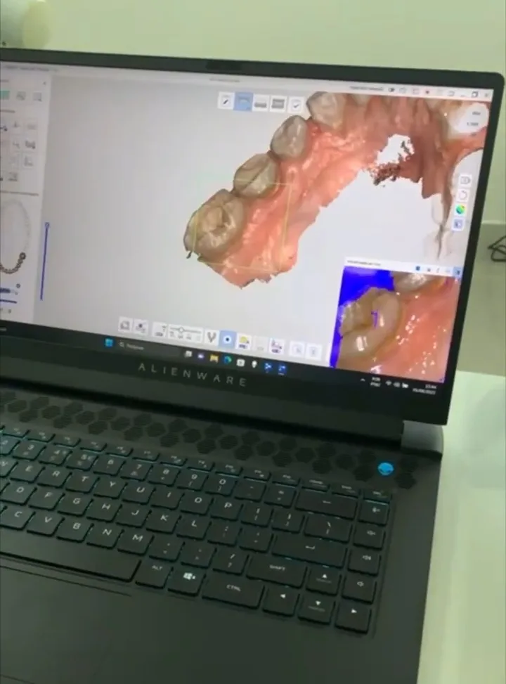 Notebook mostrando o escaneamento digital de uma arcada dentária