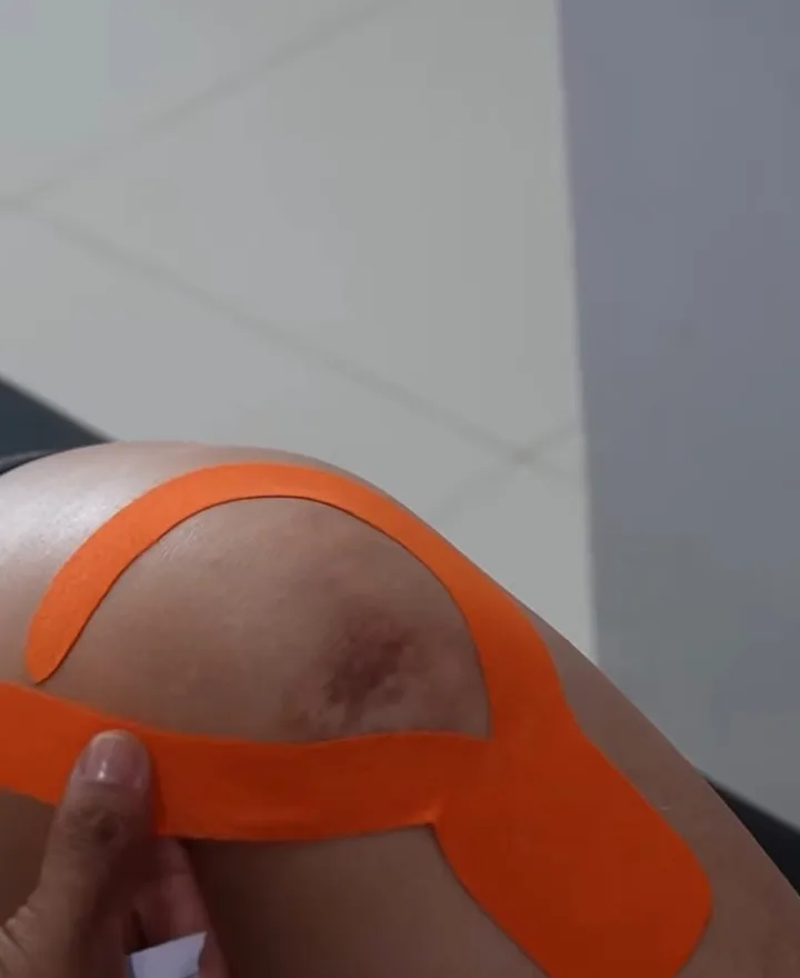 Bandagem kinesio tape laranja aplicada no joelho de um paciente